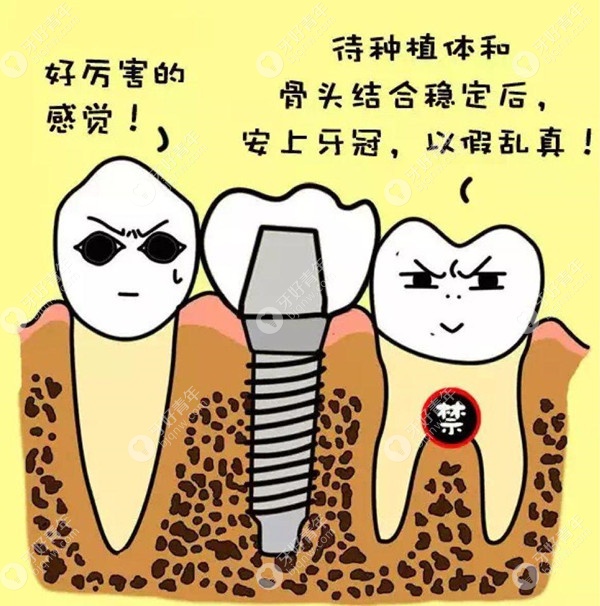 韩国登腾种植牙做完和真牙一样吗
