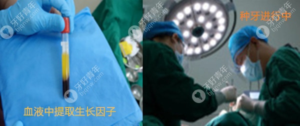 生长因子一定要冷藏吗?
