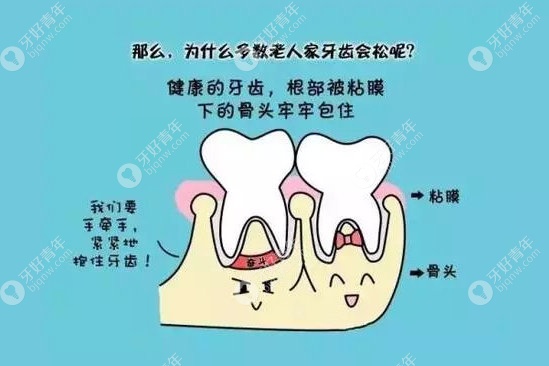牙齿松动治疗