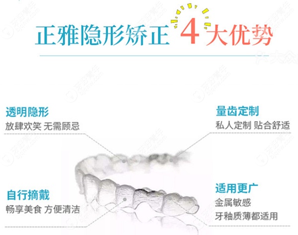 正雅隐形矫正4大优势