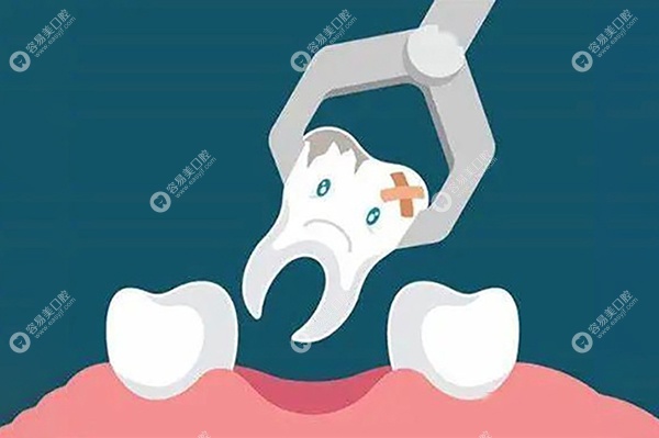 牙隐裂怎么治疗
